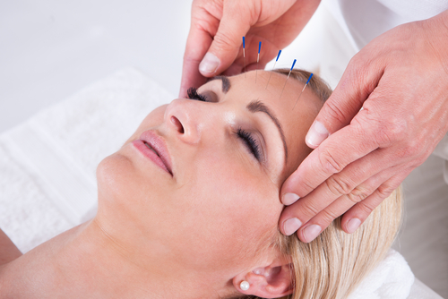 Kendall Facial Acupuncture