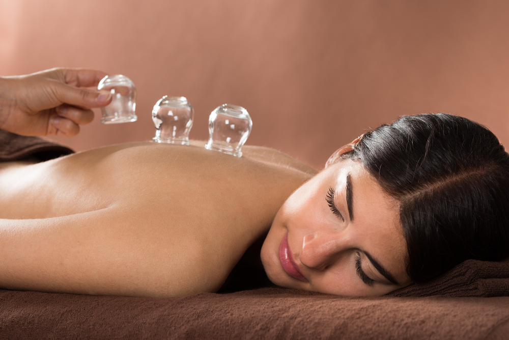 Cupping Therapy Miami
