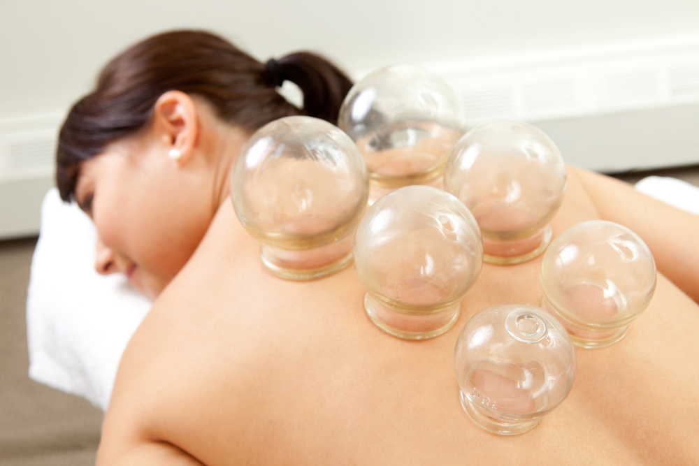 Cupping Services in Kendall
