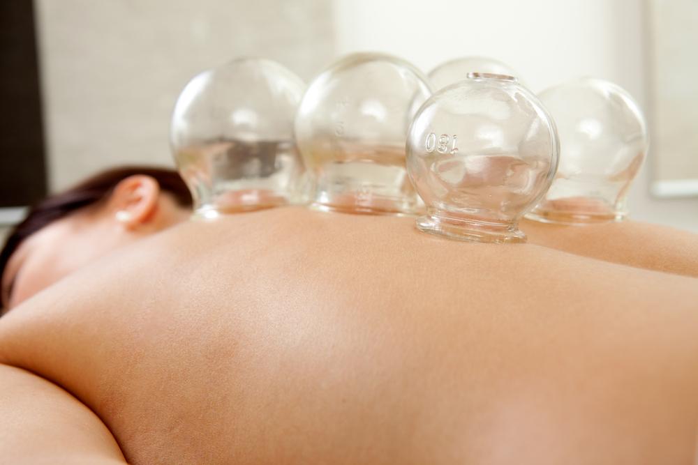 Cupping Therapy in Kendall